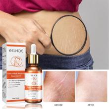 20ml Stretch Marks Removal Oil Pregnant Women Pregnancy Maternity Body Firming Treatment