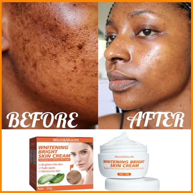Effective Spot Remover Face Cream Whitening Dark Skin Fade Pigment Freckles Melasma Brighten Skin Care Beauty Products